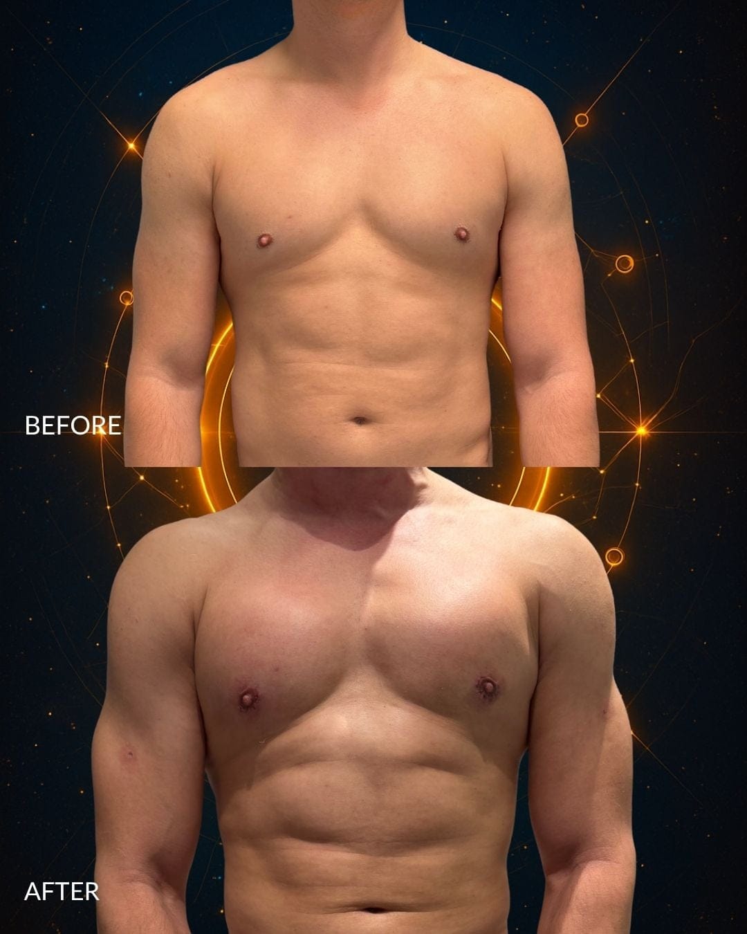 MAXORIS Body Sculpting Before and After